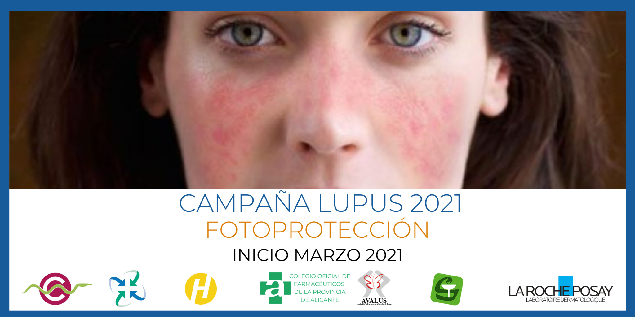 CAMPANA-FOTOPROTECCION-LUPUS-MARZO-2021