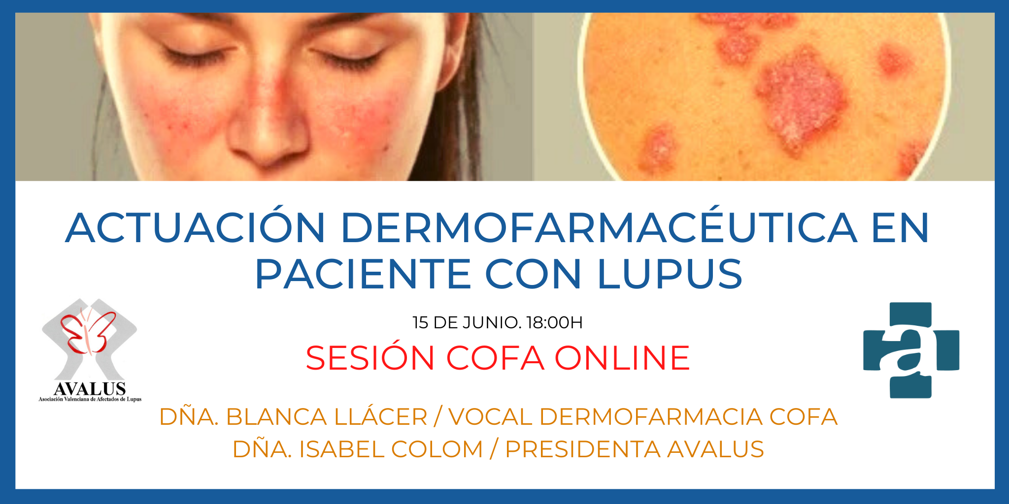 SESION-COFAAVALUS.-ACTUACION-DERMOFARMACEUTICA-EN-PACIENTE-CON-LUPUS.-15-DE-JUNIO.-1800H.-ONLINE